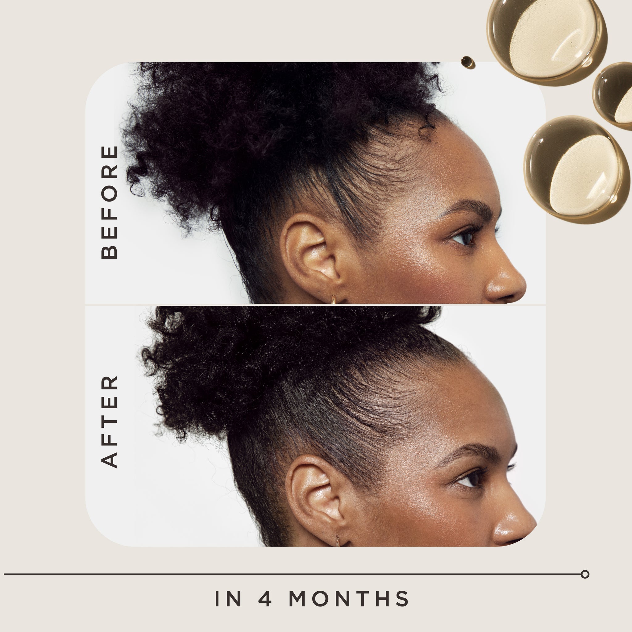 Goddess Strength Hair Regrowth Treatment